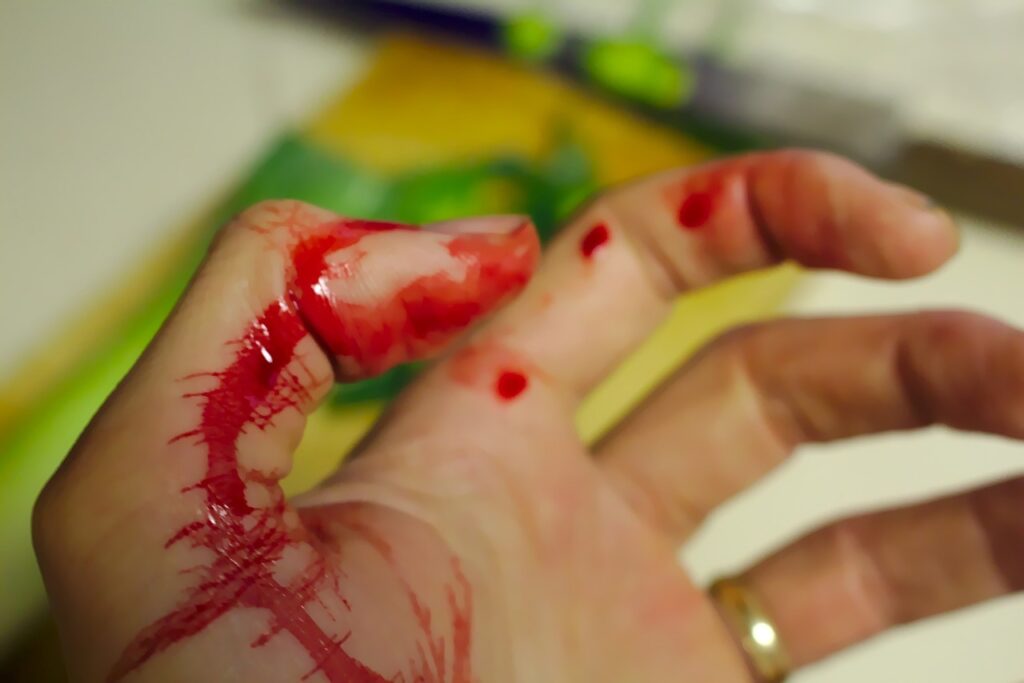 accident, bleed, bleeding-743035.jpg